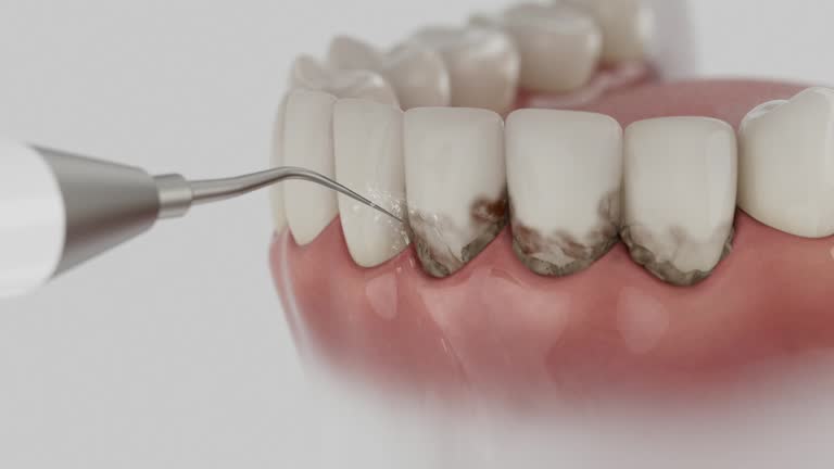 Reliable Dental Implants contractor in Fairbanks Ranch, CA by Smile Center Dentistry